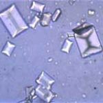 struvite